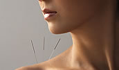 Pain Management Acupuncture