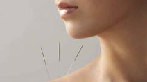 Accupuncture